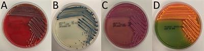 Superficieibacter electus gen. nov., sp. nov., an Extended-Spectrum β-Lactamase Possessing Member of the Enterobacteriaceae Family, Isolated From Intensive Care Unit Surfaces